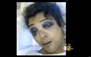 Victor Diego, 22, transgender and gay victim of brutal beating on Hollywood Boulevard.