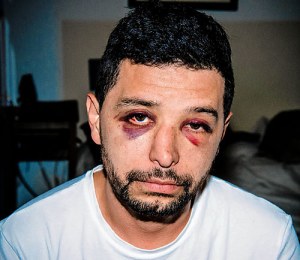 David Jimenez, a non-gay victim of anti-gay hate, was brutally beaten on September 25 while walking his dogs (Brooklyn Paper image - Stefano Giovannini).