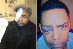Taj Patterson, 22, gay man savagely attacked by Hasidic Jews in Williamsburg, NY shouting anti-gay slurs (NY Post images).